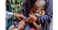 Au Bangladesh, le retour de la rougeole r�v�le l'�rosion silencieuse d'un syst�me de sant�