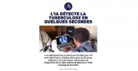 La r�forme mondiale de la sant� doit favoriser l'innovation